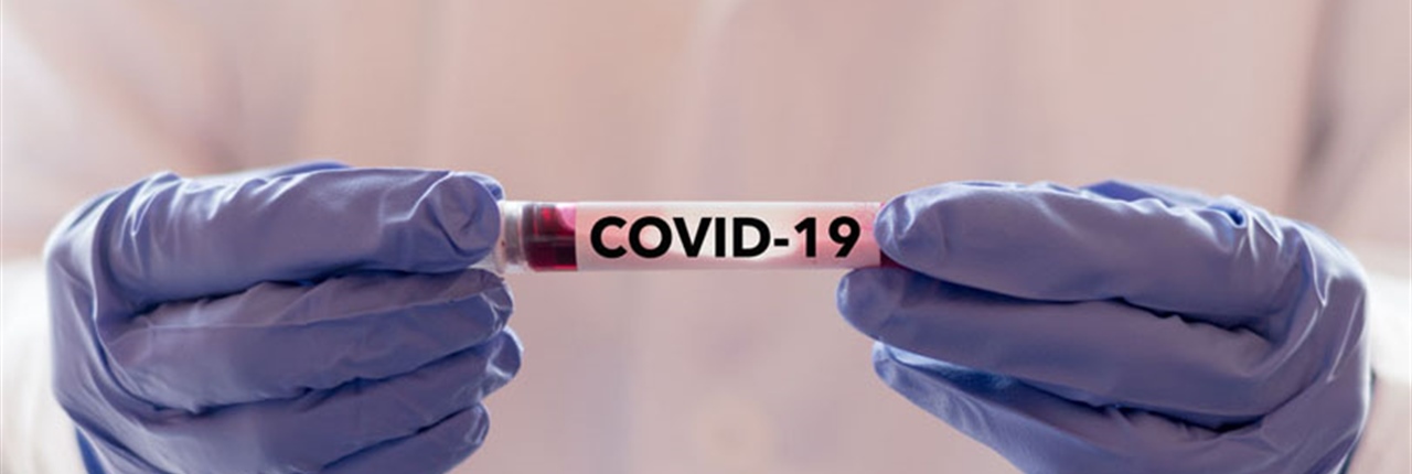 EEOC Issues Guidance Regarding Testing/Screening Employees, Call-Offs, Return to Work Protocols and more during COVID-19 Pandemic