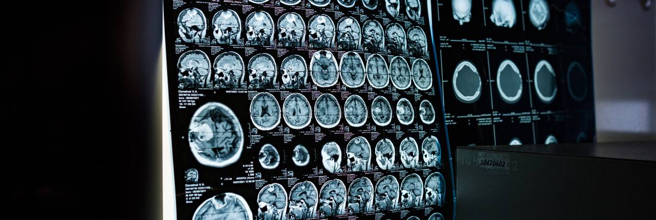 New White Paper: The Value of Generic Contrast Utilization in Imaging