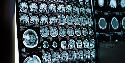 New White Paper: The Value of Generic Contrast Utilization in Imaging